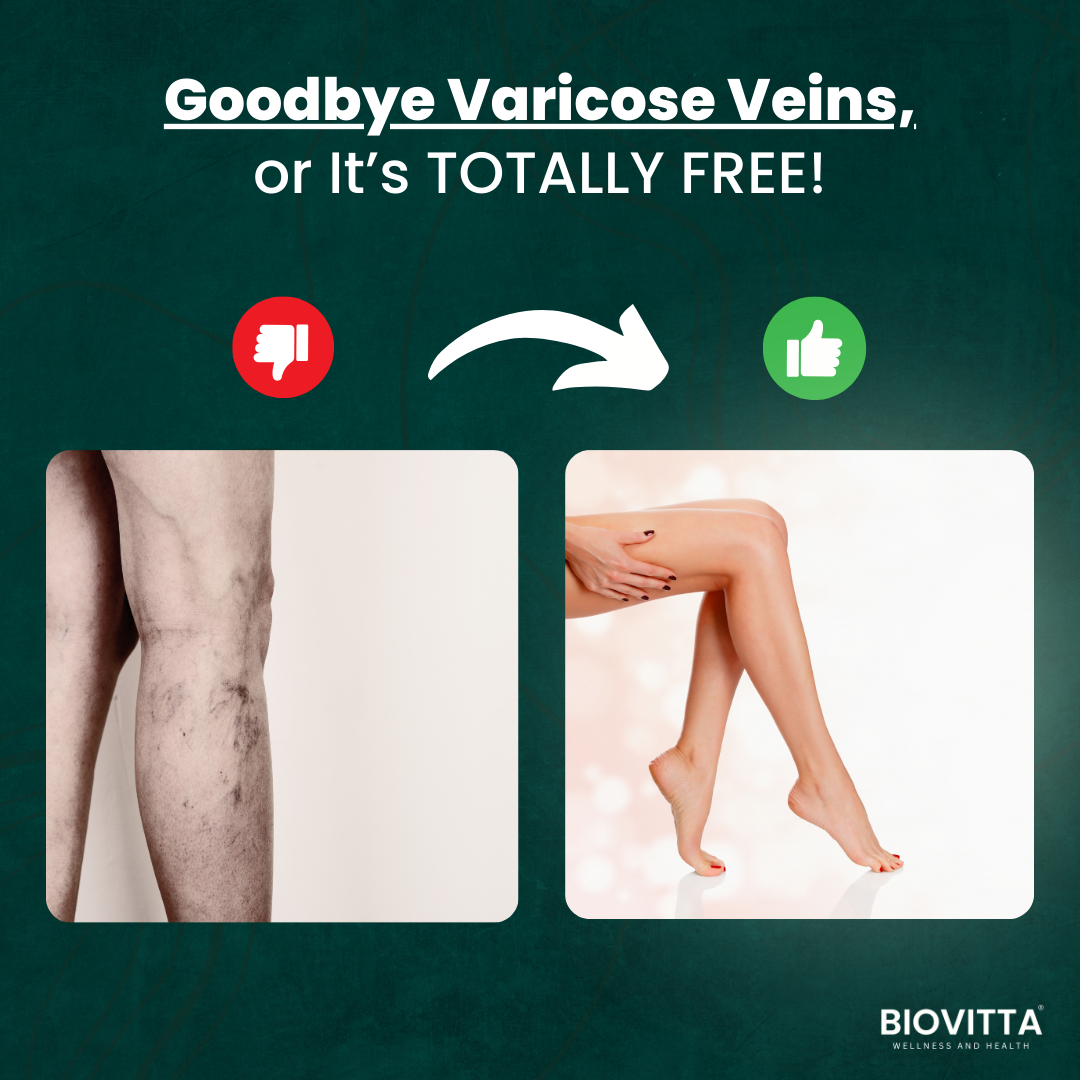 VenoClear™ Varicose Veins Treatment