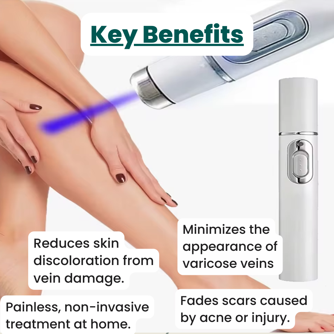 VenoClear™ Varicose Veins Treatment